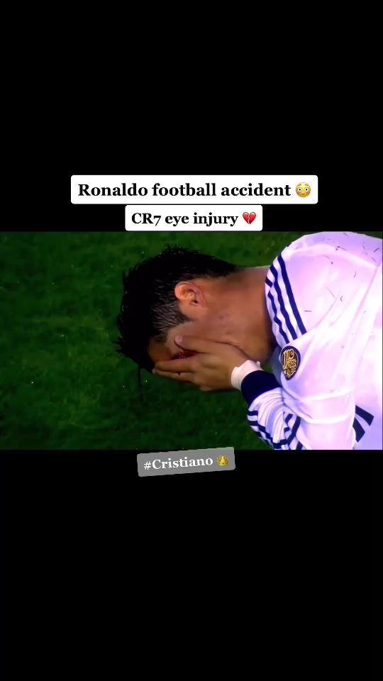 Tik Tok La blessure a loeil de Ronaldo